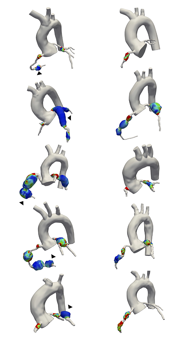 Simulations of blood flow