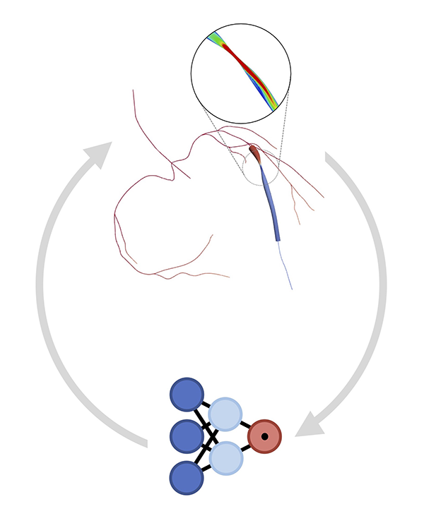 Pressure of bloodflow