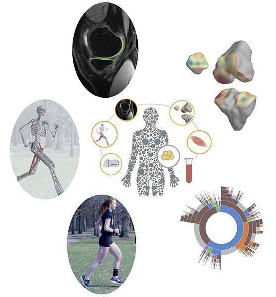 Graphic showing the role of mechanics in osteoarthritis