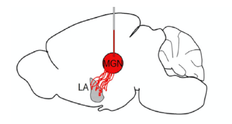 illustration of neuromodulation for substance abuse disorders