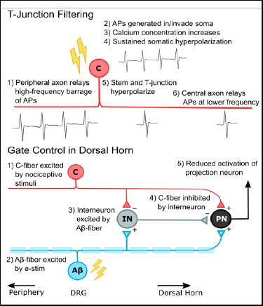 t-junction filtering and gate control in dorsal horn (diagram)