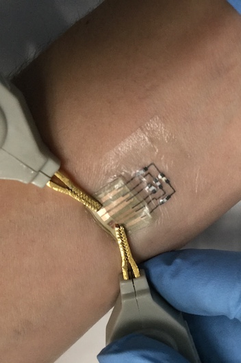 e-tattoo