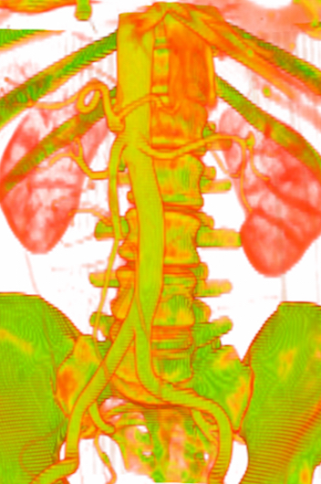 computational model